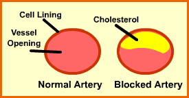Lipid